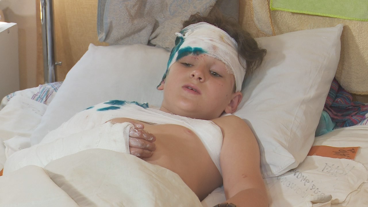 У лікарні Дніпра залишається один полтавський школяр, поранений під час зіткнення автобуса з дітьми та вантажівки